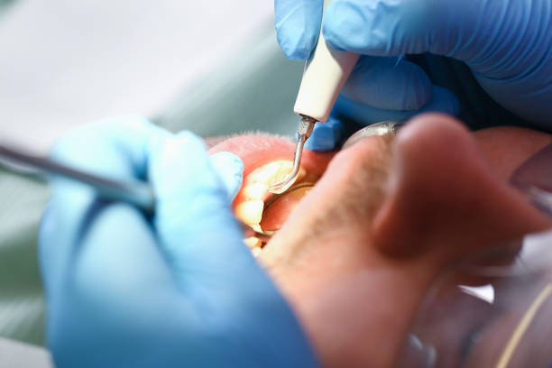 Best Dentist for Tooth Abscess  in Arnold, MD