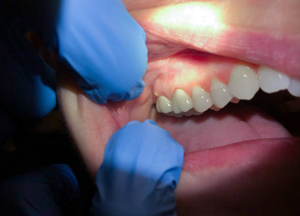 Best Broken Tooth Emergency  in Arnold, MD